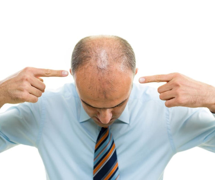 Understanding and Combating Hair Loss in Men